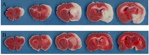 ▲ J. Zhu et al. / Neuroscience 202 (2012) Fig.1에서 발췌.