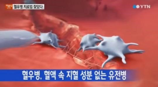 SK케미칼 개발 혈우병 치료제
출처:/ YTN 뉴스 캡처