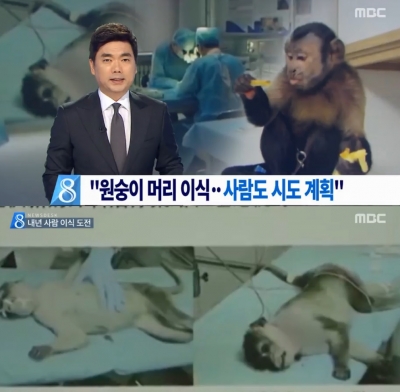 원숭이 머리 이식 성공
출처:/ MBC 뉴스화면 캡처