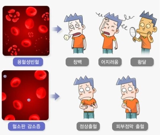 개의 에반스 증후군 무서운 입원과 퇴원까지의 것. (용혈성 빈혈, 혈소판 감소증) (2) 1