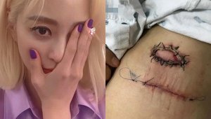 기사 섬네일