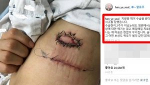 기사 섬네일