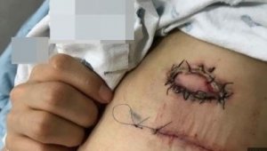 기사 섬네일