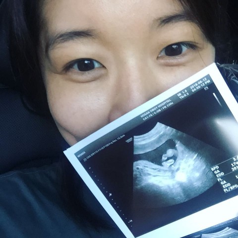 김빈우 임신, 연년생 엄마 된다 "행복합니다"