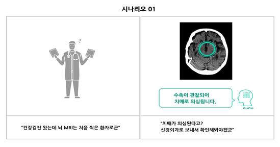 의료영상 판독보조 서비스 구현 사례