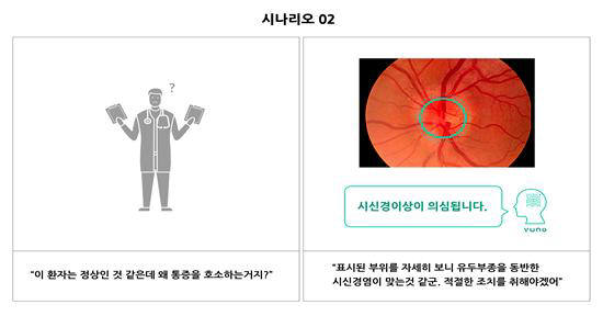 의료영상 판독보조 서비스 구현 사례