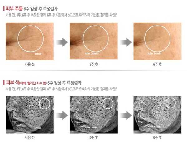 <비타민스킨세트의 임상실험 결과>