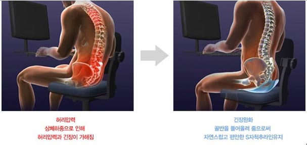 25년만에 만든 허리 방석, 무슨 원리지?