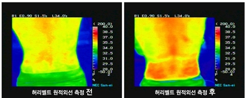 ▲ 토르마린 온열벨트 착용 전 후 원적외선 온도변화