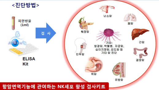 에이티젠이 이번에 출시한 `엔 케이 뷰 키트`의 진단방법