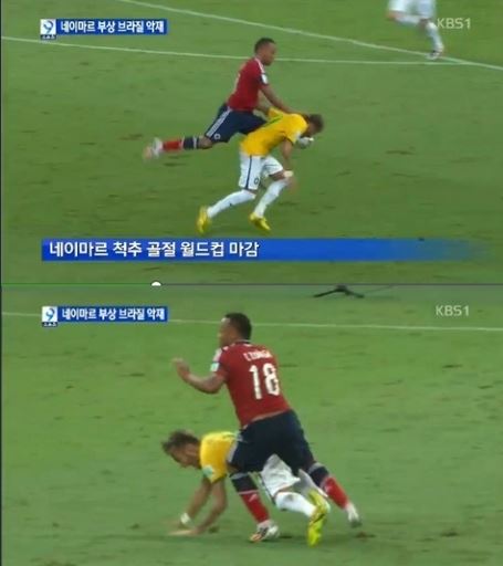 브라질 독일 수니가