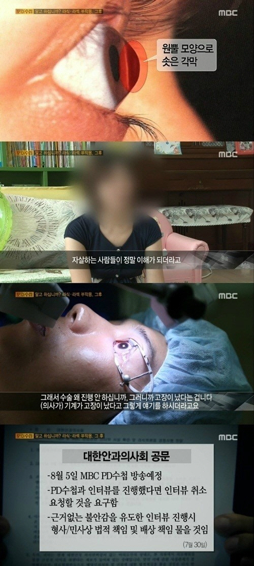 pd 수첩 대한안과의사회 스벤리박사