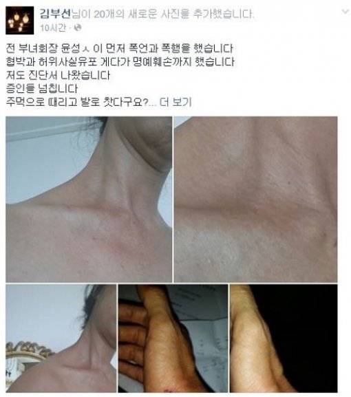 출처:/김부선 SNS/김부선 폭행 혐의