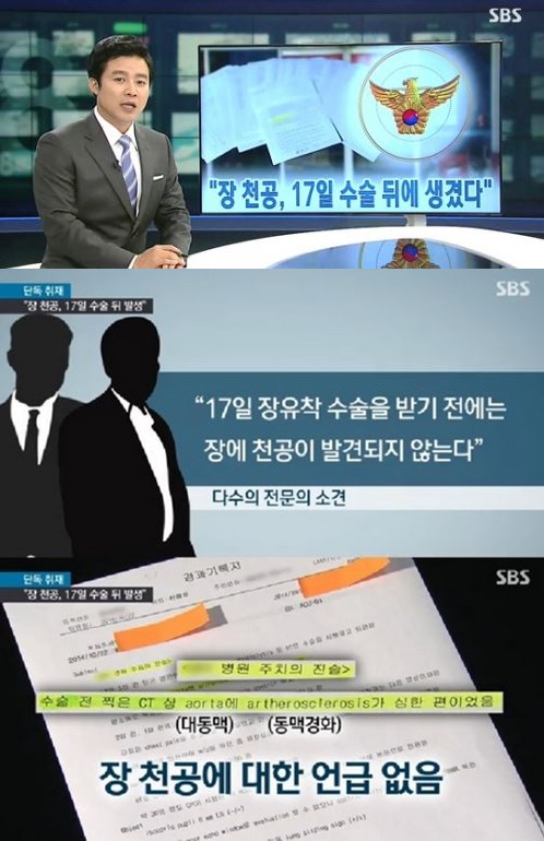 신해철 소장천공
 출처:/SBS