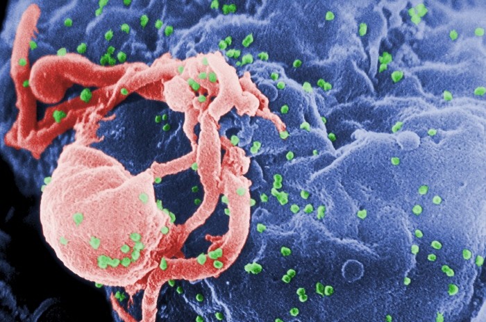 약해진 HIV…완전 무해 가능성도 있다?