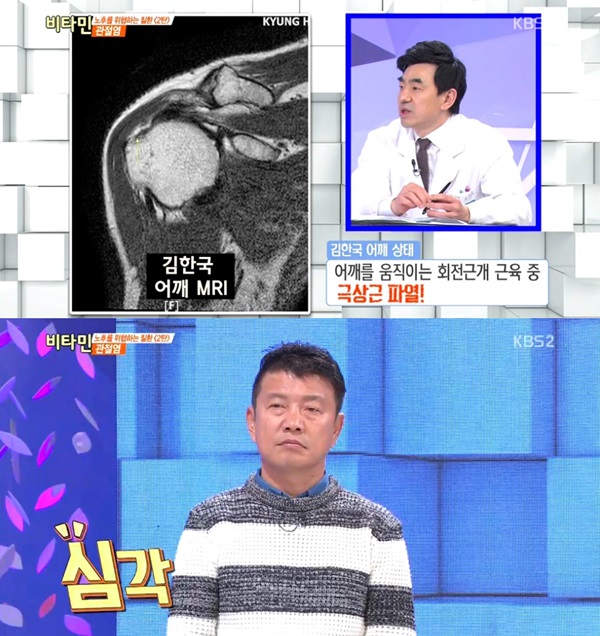 출처:/ KBS 비타민 캡쳐