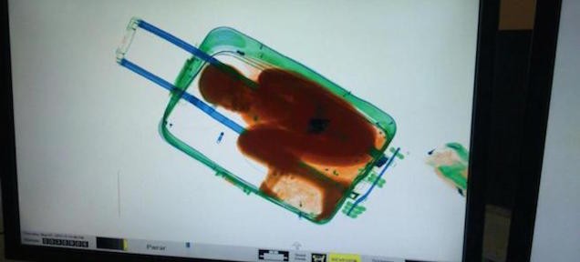 엑스레이 영상에 잡힌 ‘안타까운 밀입국’