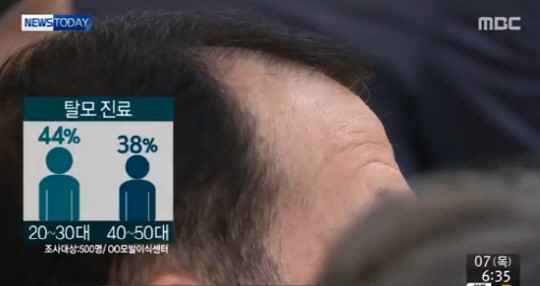 탈모 예방에 좋은 체조
 출처:/ MBC