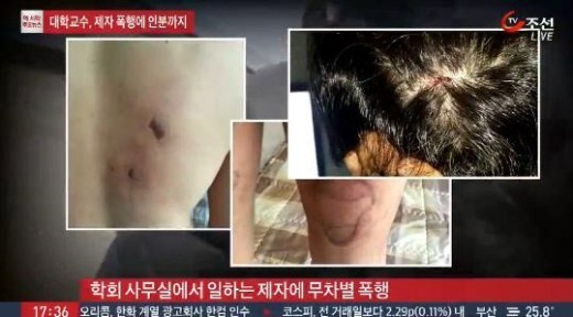 인분교수 위자료 130만원
 출처:/ TV조선