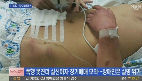 출처:/MBN 뉴스