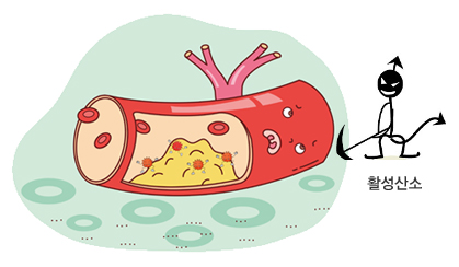 [홍성재 원장 의학칼럼]  활성산소는 혈관을 오염시킨다
