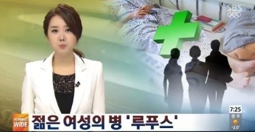 전신성 홍반성 낭창 증상
 출처:/SBS 화면 캡쳐