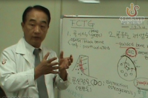 임플란트 부작용, 알고 치료받자