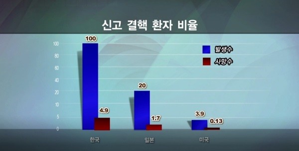 결핵 발생률
 출처:/메디컬TV