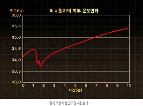 전기,배터리 없이 닿기만해도 4시간 찜질 "믿을 수 없어"