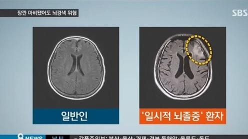 뇌졸중의 종류와 원인
 출처:/ SBS 캡처