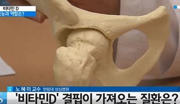 비타민D 결핍증
 출처:/ YTN 캡처