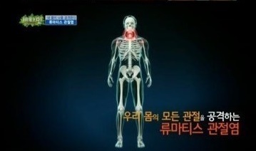 관절염에 좋은 운동
 출처:/ KBS2 화면 캡쳐