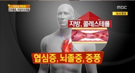 고지혈증에 피해야할 음식
 출처:/ MBC방송 캡쳐