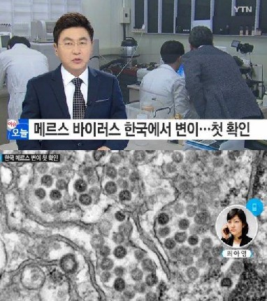 메르스 바이러스 변이
 출처:/YTN 뉴스 캡처
 
 
 