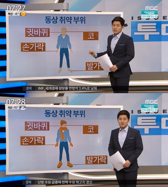 동상의 증상
 출처:/ MBC 뉴스투데이 캡쳐