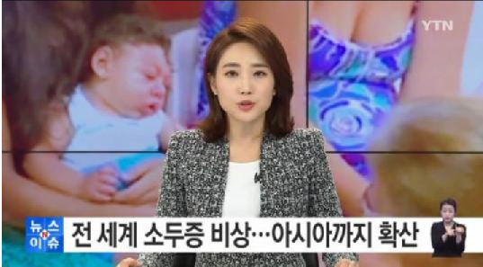 소두증 지카바이러스
 출처:/YTN 뉴스 캡처
 