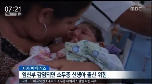 지카바이러스 증상
 출처:/ MBC 캡처