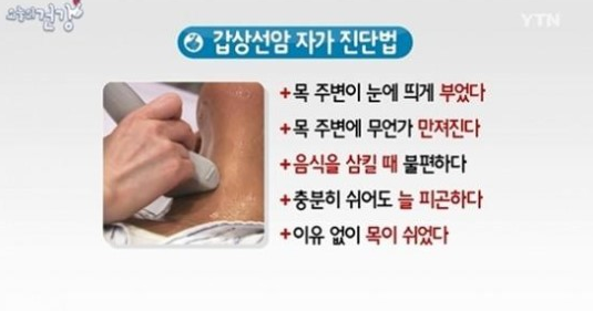 갑상선기능항진증 증상
 출처:/ YTN 캡처