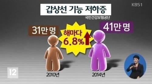 갑상선기능항진증 증상
 출처:/ KBS 뉴스 캡쳐