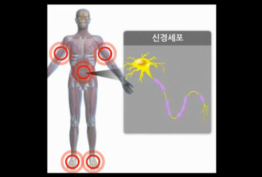 길랭 바레 증후군이란
 출처:/ 네이버 지식백과 