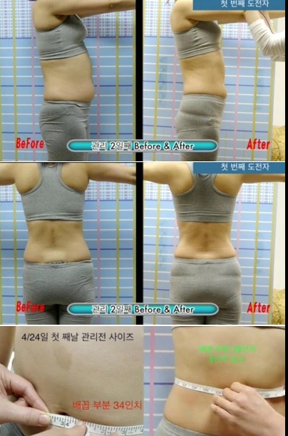 갈수록 걱정되는 비만&#8231;웨딩케어관리…부천피부관리실 ‘금단비가’에서 한번에 해결