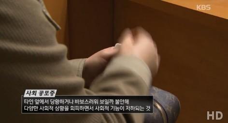 사회공포증 증상, 출처:/KBS 뉴스