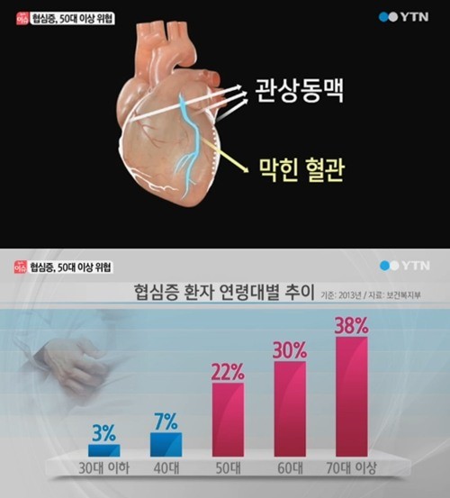 협심증 예방습관
 출처:/YTN뉴스 캡쳐