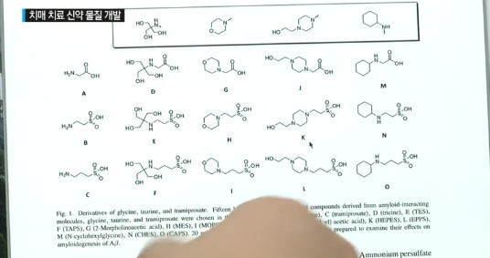 초로기치매 예방
 출처:/ YTN 캡처(기사와 무관)