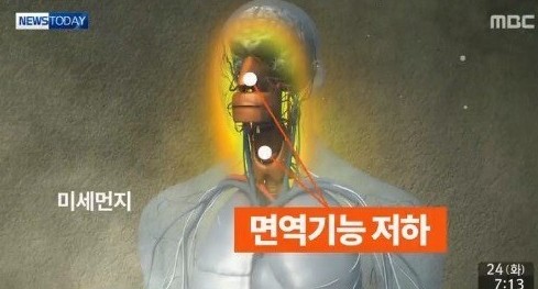 황사철 호흡기질환 주의
 출처:/ MBC 캡처