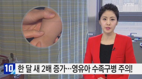 수족구병 증상
 출처:/ YTN 캡처