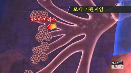 출처:/ KBS1 캡처