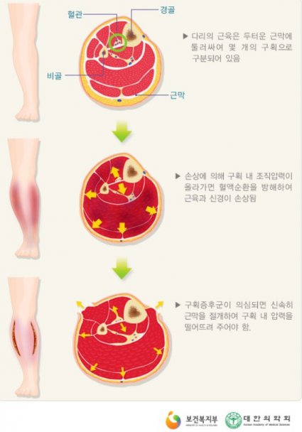 사진=보건복지부