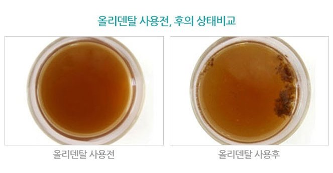 치주염, 구취 막는데 이 방법이 최고