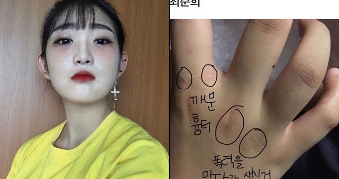 최준희 추가 폭로…폭행사진 공개 “전 진실만을 말한다”